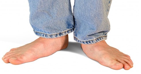 Ноги взрослого человека с плоскостопием