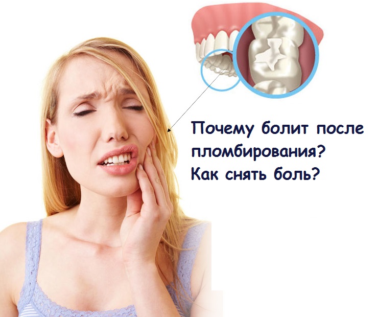 Зубная боль после пломбирования