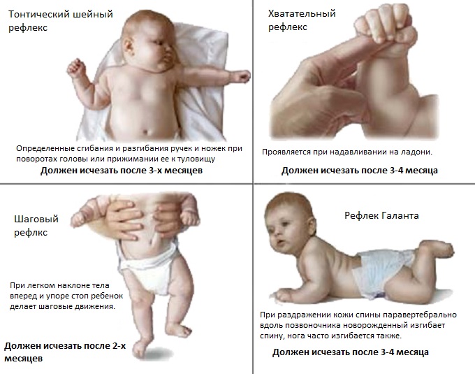 Рефлексы новорожденных в норме